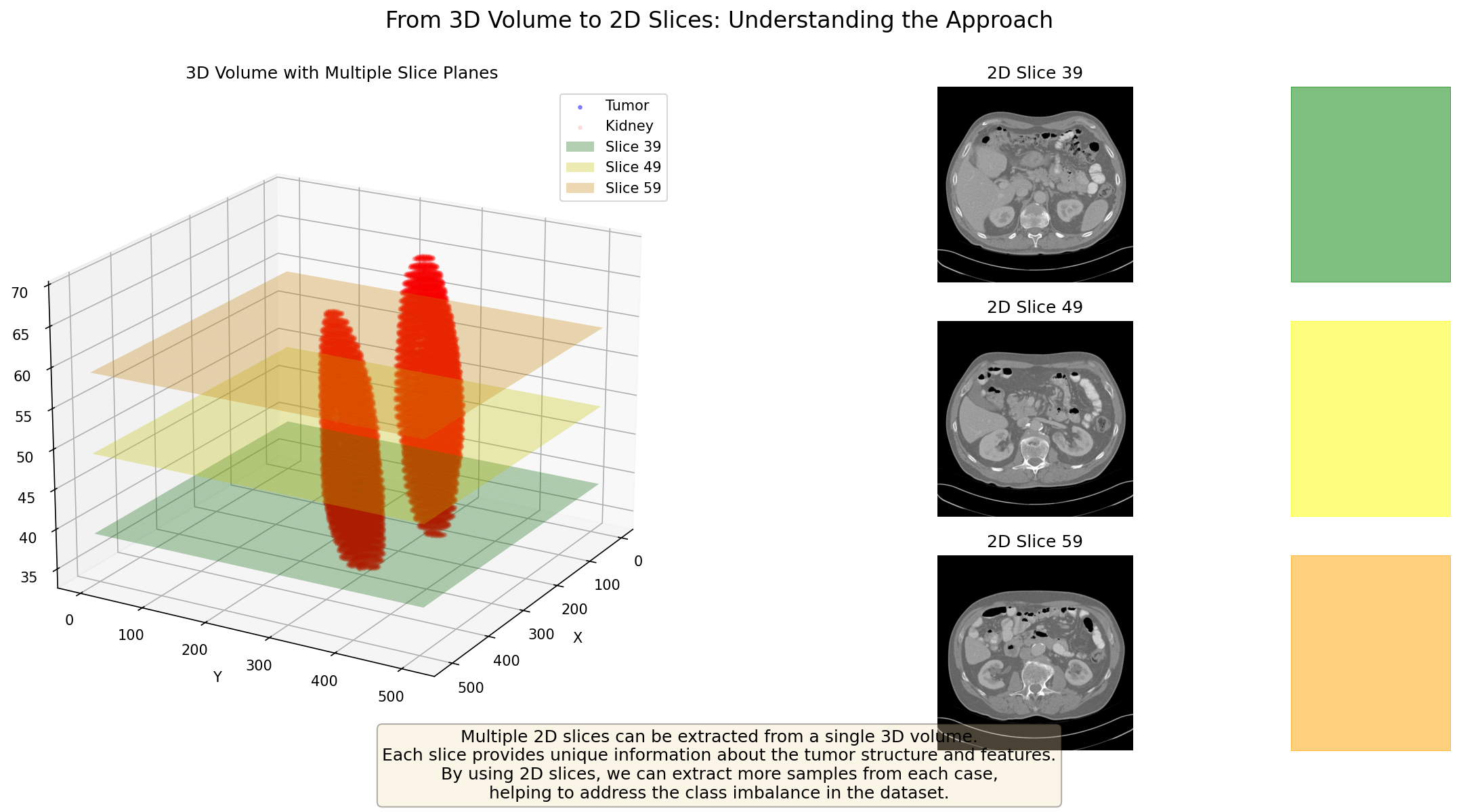 Diagram showing how 3D volumetric data is transformed into multiple 2D slices along different planes for optimal model training