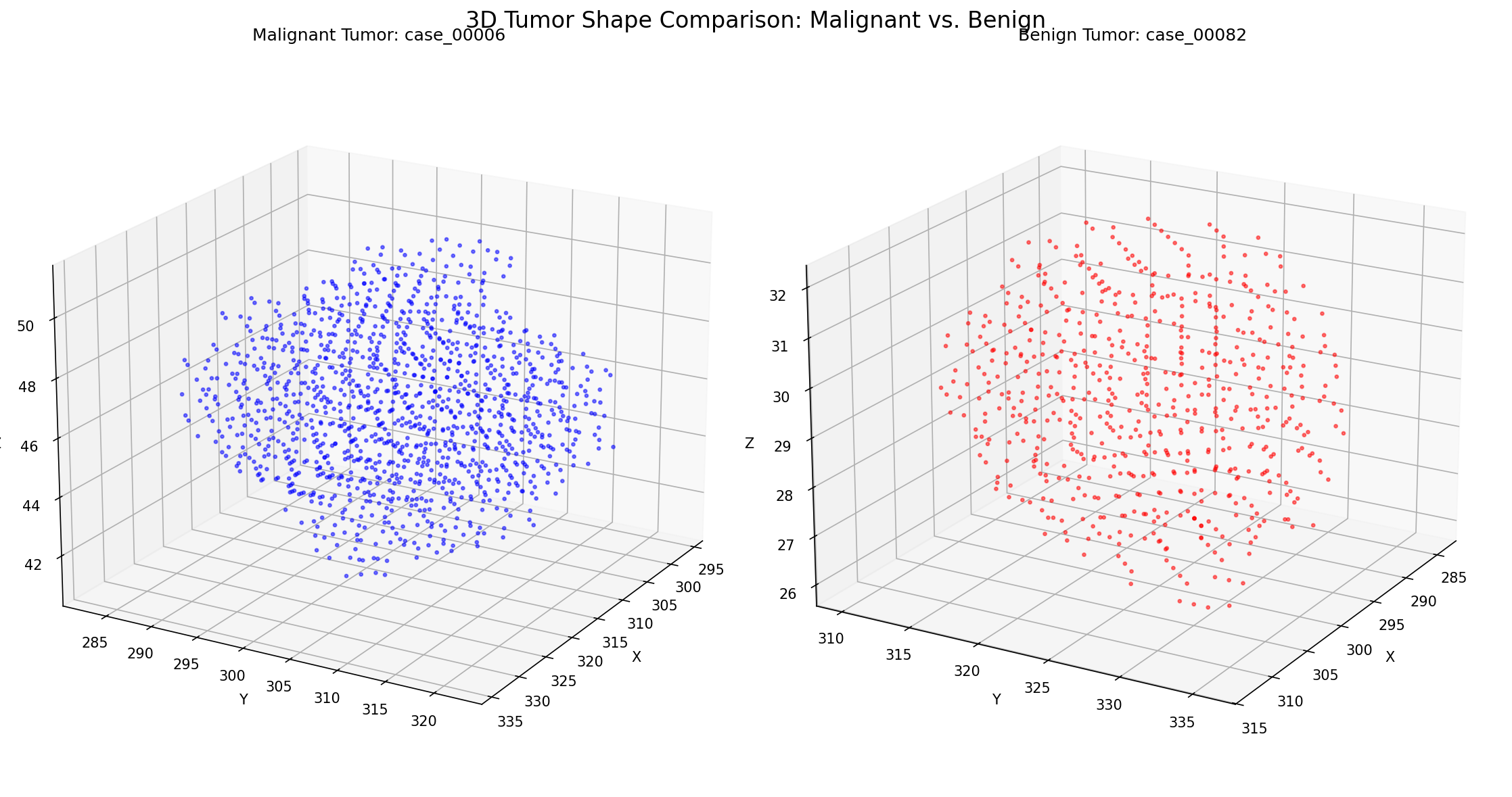 Side-by-side comparison of 3D representations of malignant (left) and benign (right) kidney tumors, highlighting morphological differences