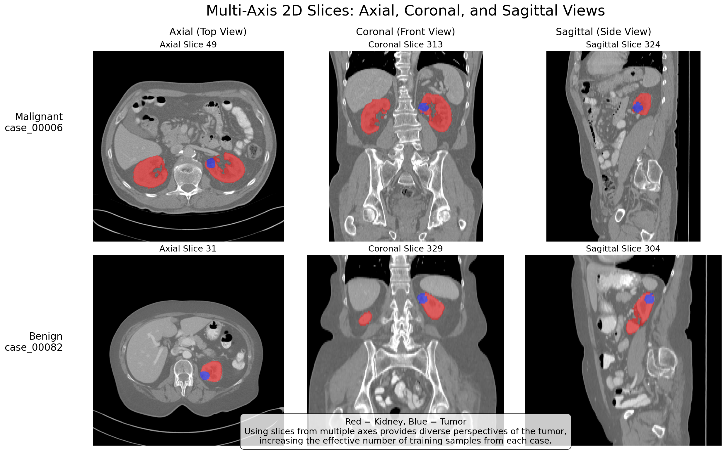 CT Scan AI Analysis