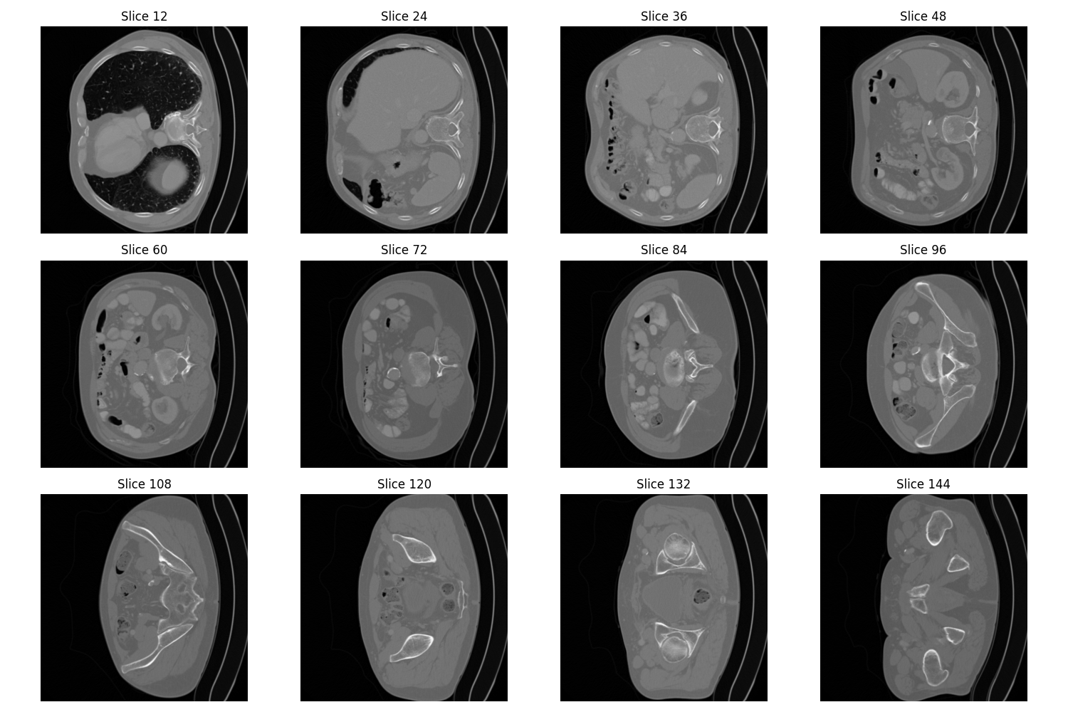 Montage image of a malignant tumor