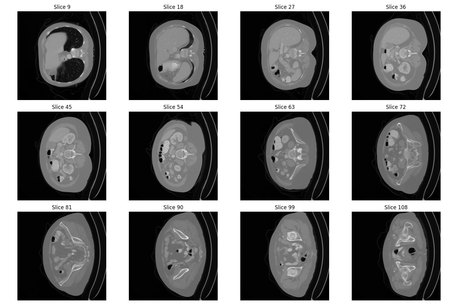 Montage image of a benign tumor