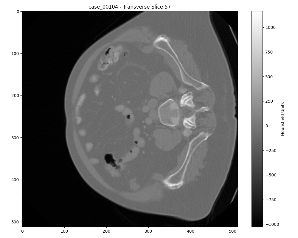 Another axial slice of a benign tumor