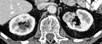 Standard Monochromatic CT Input