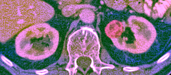 Synthesized Multi-Spectral Output