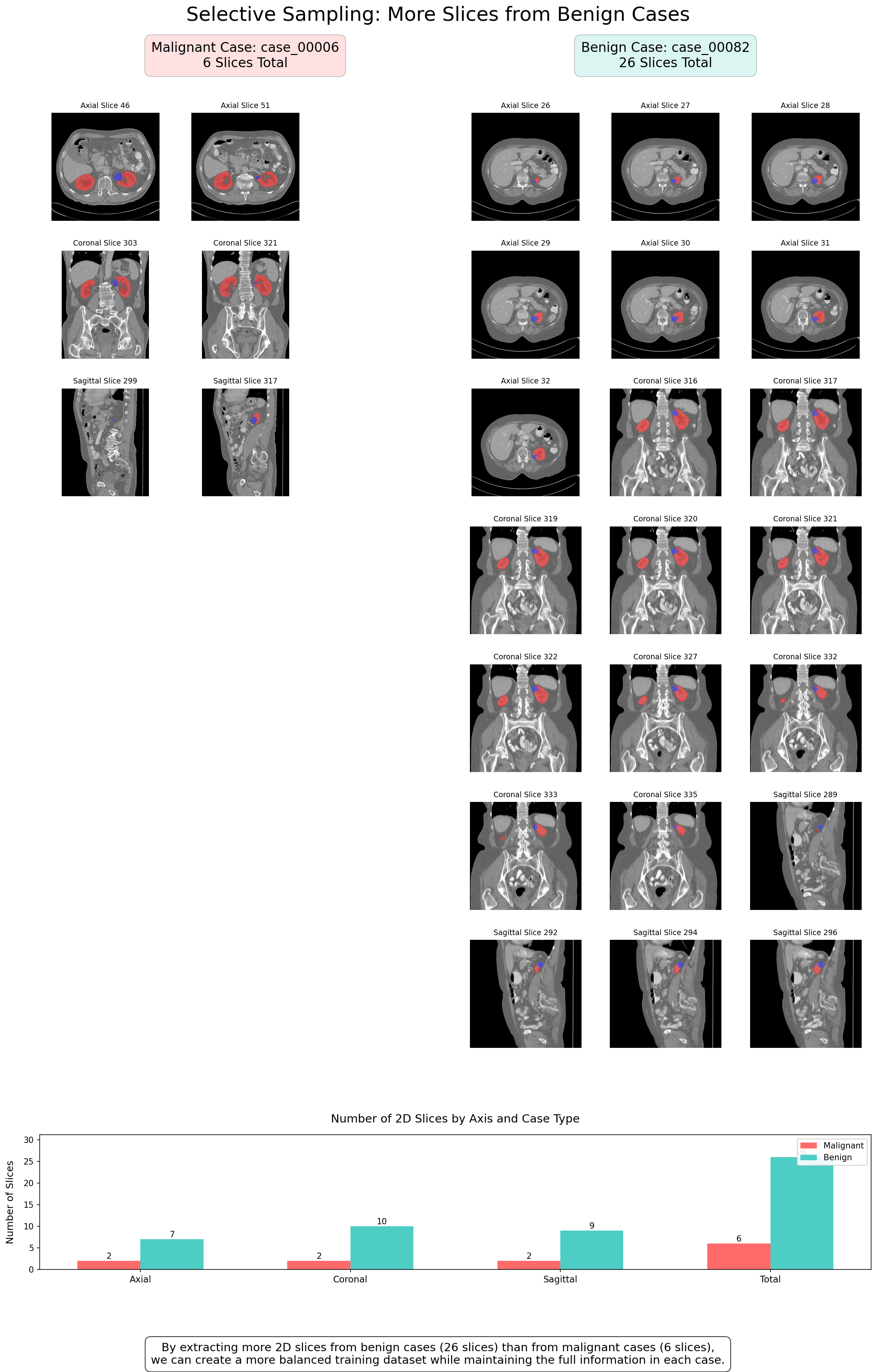 Intelligent selective sampling method